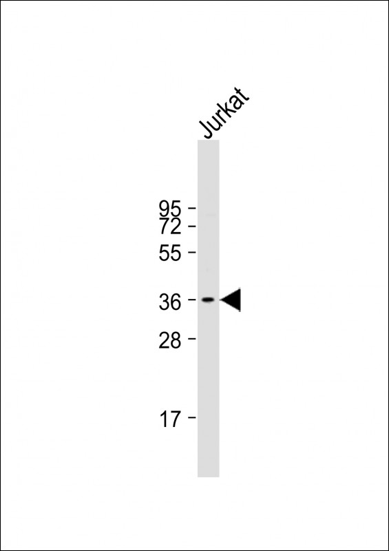 Rabbit Polyclonal Antibody to RFPL3 (N-term)