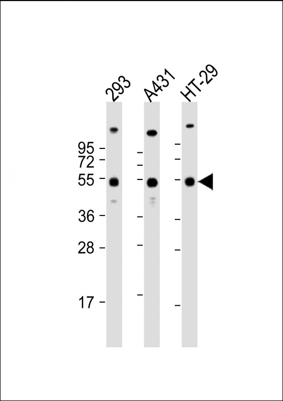 Rabbit Polyclonal Antibody to TP53