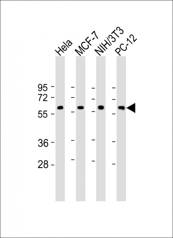 Rabbit Polyclonal Antibody to TP53 (N-term)