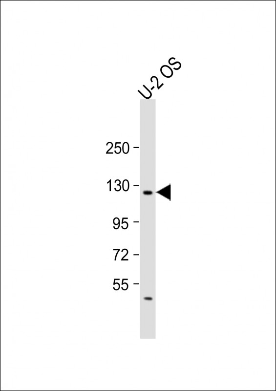 Rabbit Polyclonal Antibody to LIFR