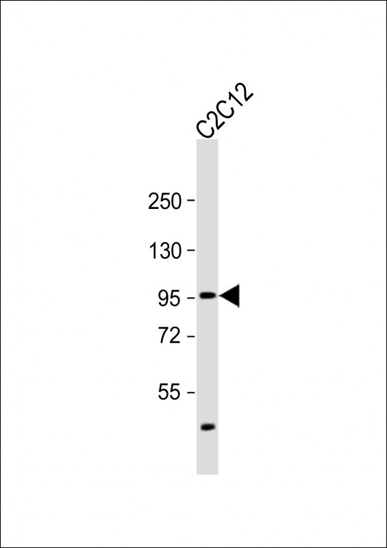 Rabbit Polyclonal Antibody to SMURF2