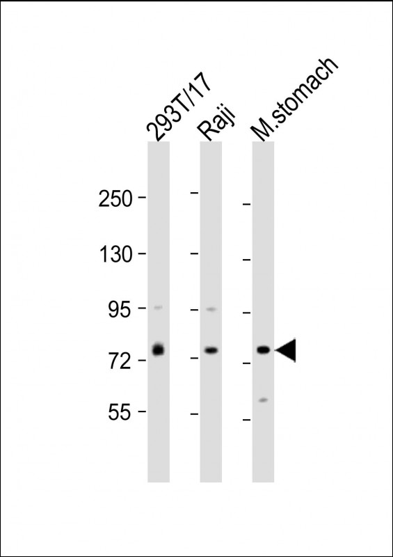 Rabbit Polyclonal Antibody to PLA2G4F