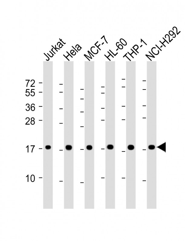 Rabbit Polyclonal Antibody to RPS17