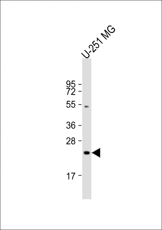 Rabbit Polyclonal Antibody to LHPP