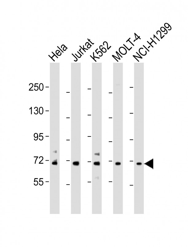 Rabbit Polyclonal Antibody to NUP85 (N-Term)