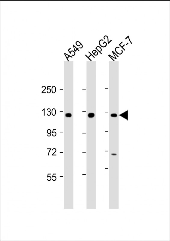 Rabbit Polyclonal Antibody to KLB (N-Term)