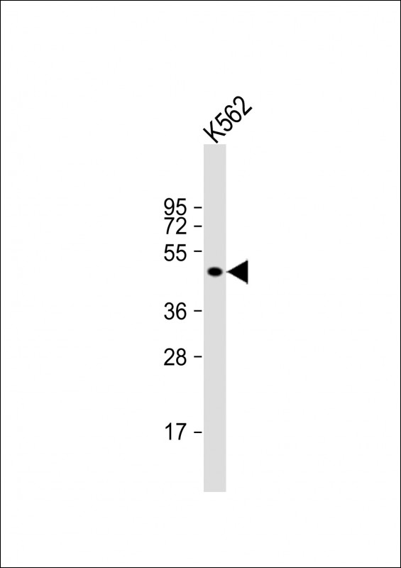 Rabbit Polyclonal Antibody to EIF5