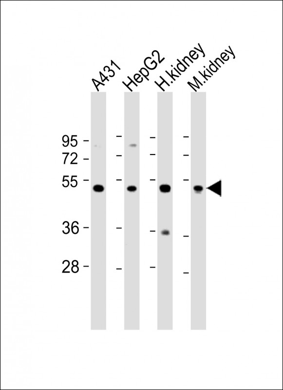 Rabbit Polyclonal Antibody to VNN1 (N-Term)