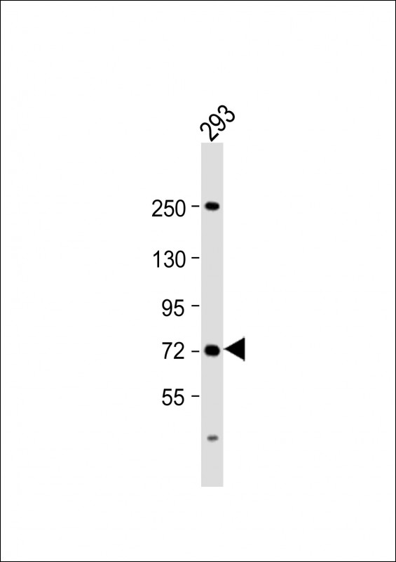 Rabbit Polyclonal Antibody to SLC6A19