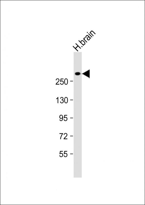 Rabbit Polyclonal Antibody to JMJD1C