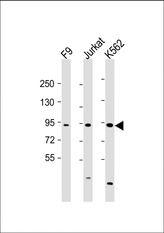 Rabbit Polyclonal Antibody to NUP93 (N-Term)