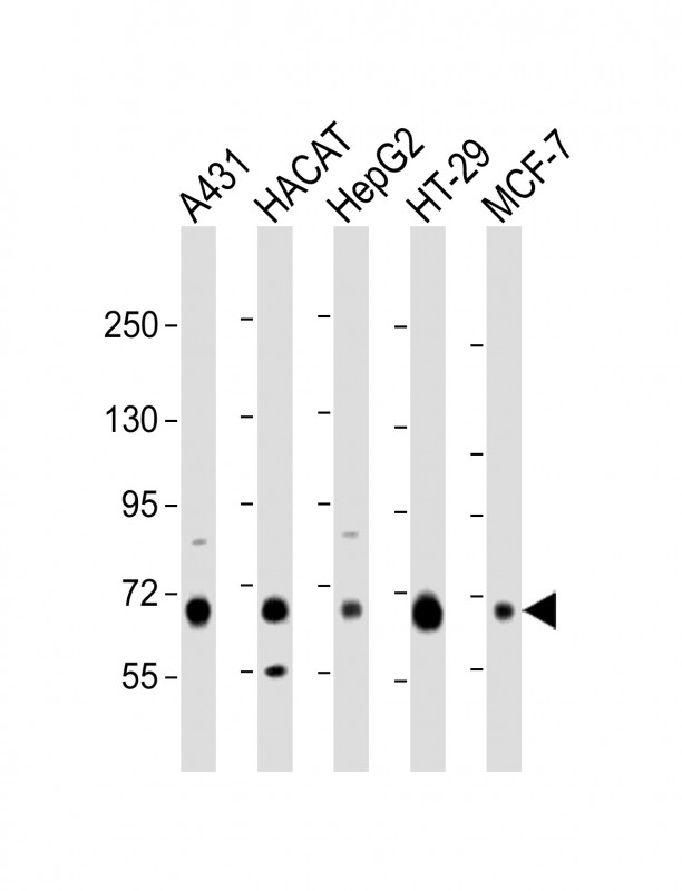 Rabbit Polyclonal Antibody to LSR