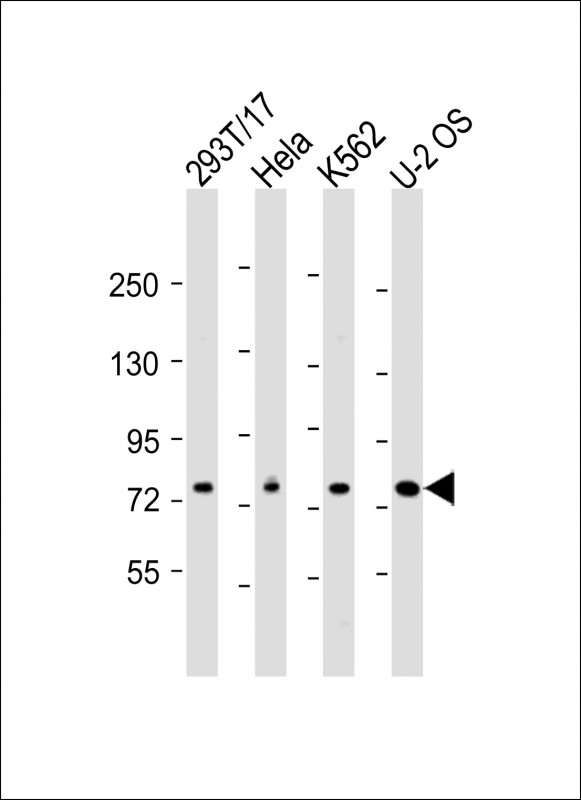 Rabbit Polyclonal Antibody to NDC80