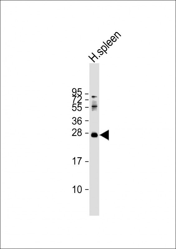 Rabbit Polyclonal Antibody to PRTN3