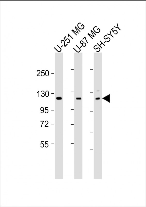 Rabbit Polyclonal Antibody to SH3PXD2B
