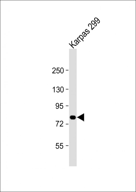Rabbit Polyclonal Antibody to ALK