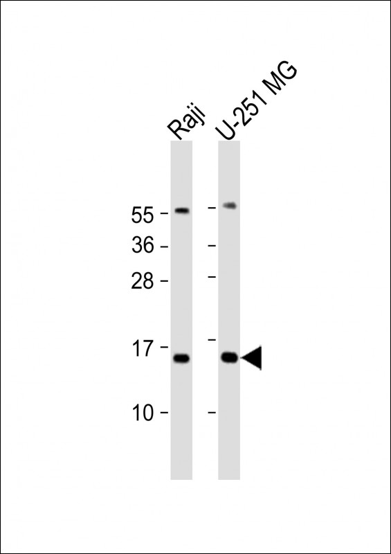 Rabbit Polyclonal Antibody to NT5C (N-Term)