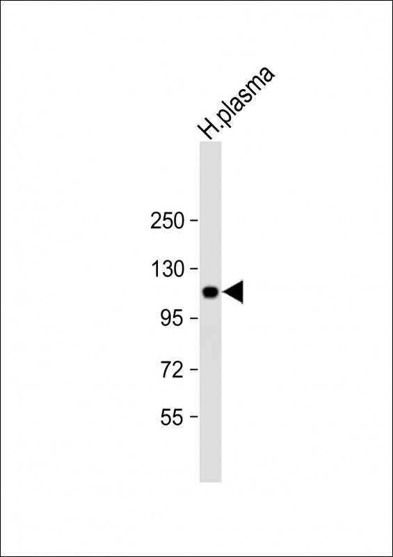Rabbit Polyclonal Antibody to ITIH4