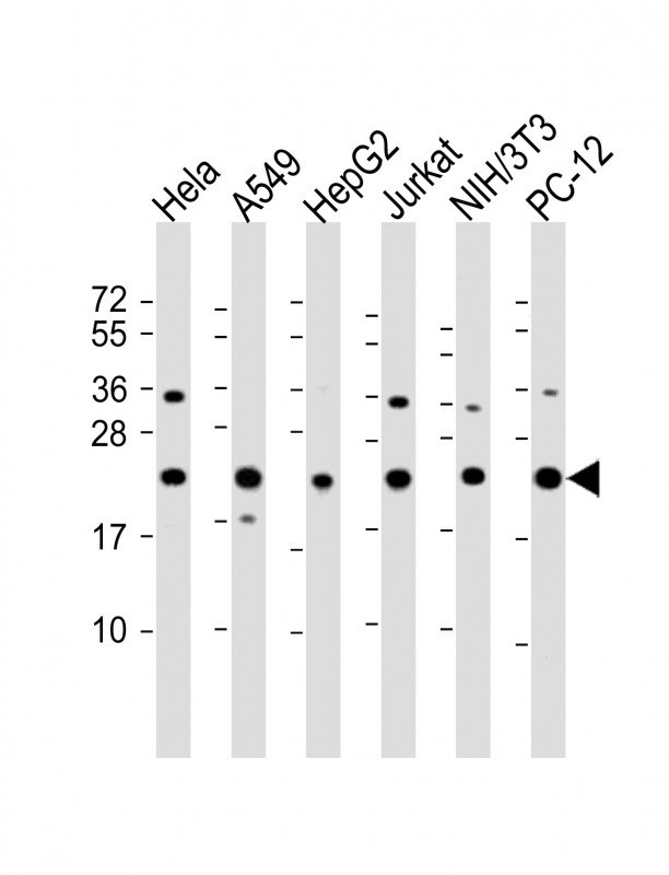 Rabbit Polyclonal Antibody to RPS7
