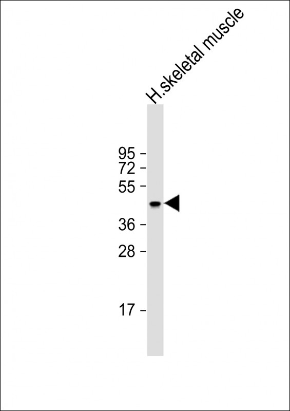 Rabbit Polyclonal Antibody to ERVK-21