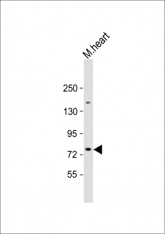 Rabbit Polyclonal Antibody to SLC6A8 (N-Term)