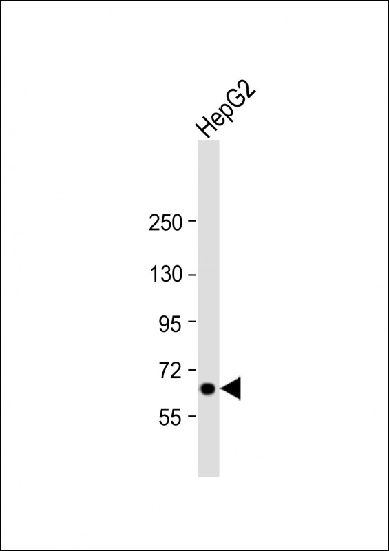 Rabbit Polyclonal Antibody to LSR (N-Term)