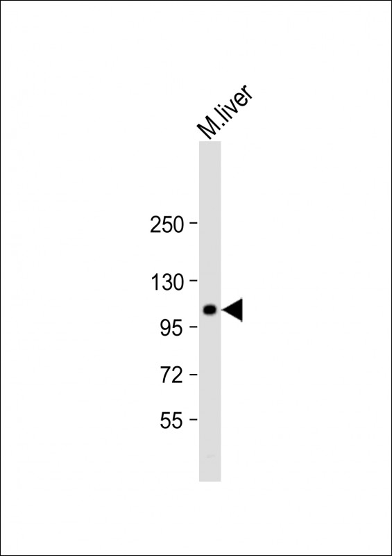 Rabbit Polyclonal Antibody to GART