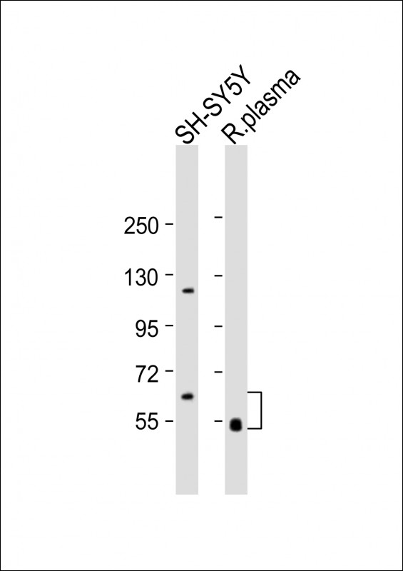 Rabbit Polyclonal Antibody to GAS6