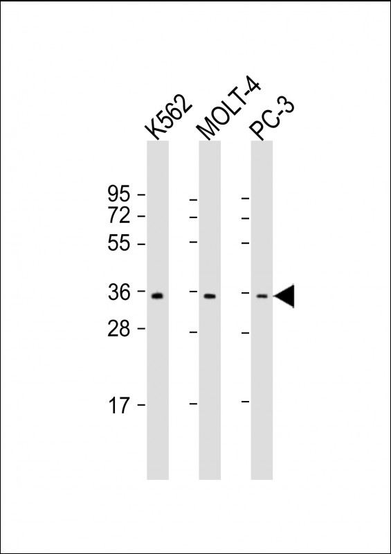 Rabbit Polyclonal Antibody to PIGC