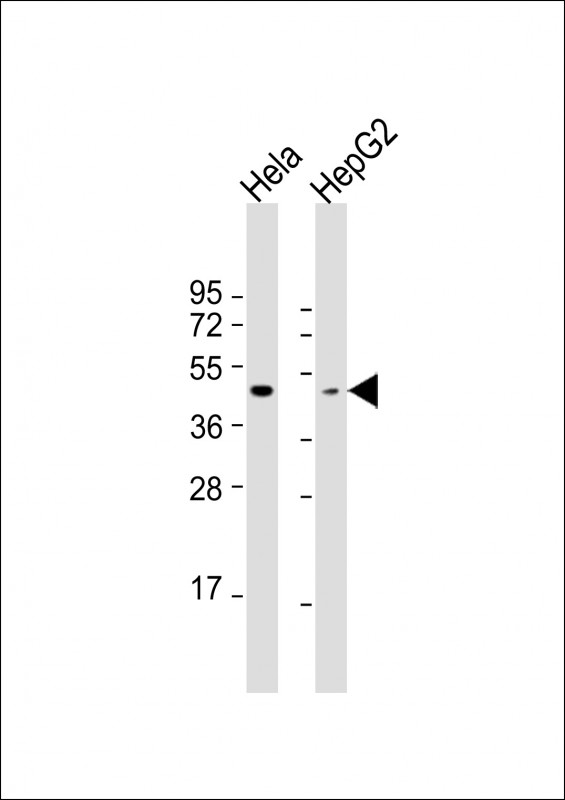 Rabbit Polyclonal Antibody to OPN1MW (N-term)