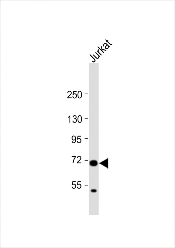 Rabbit Polyclonal Antibody to HAUS5  (N-term)