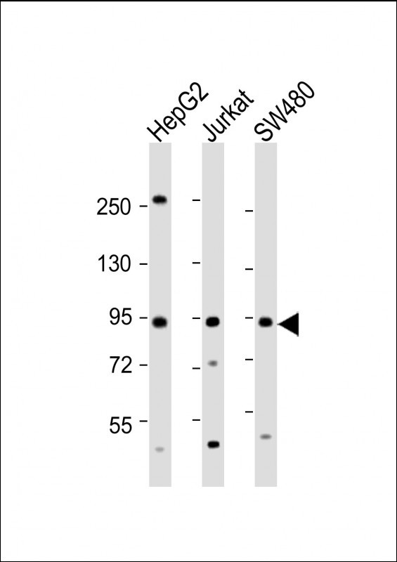 Rabbit Polyclonal Antibody to TAP1