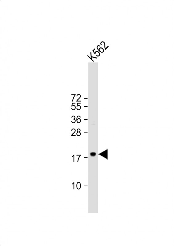 Rabbit Polyclonal Antibody to TSPAN2