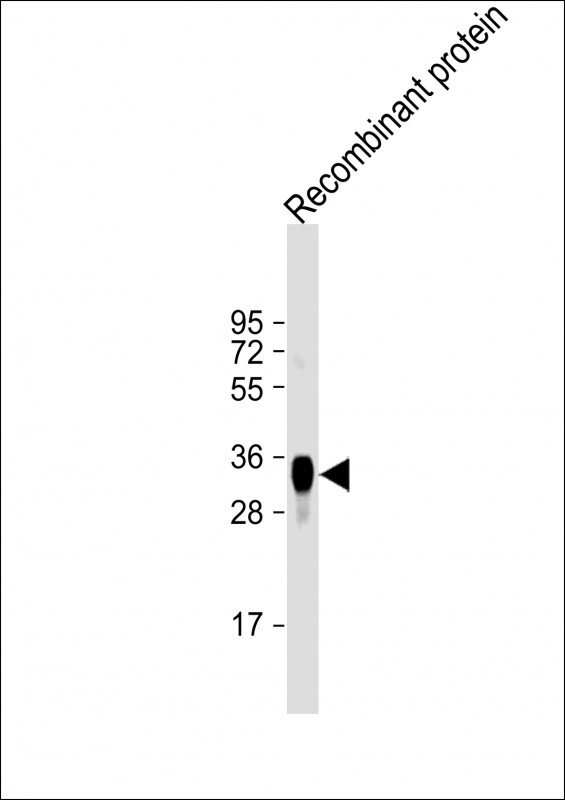 Mouse Monoclonal Antibody to LRP1B