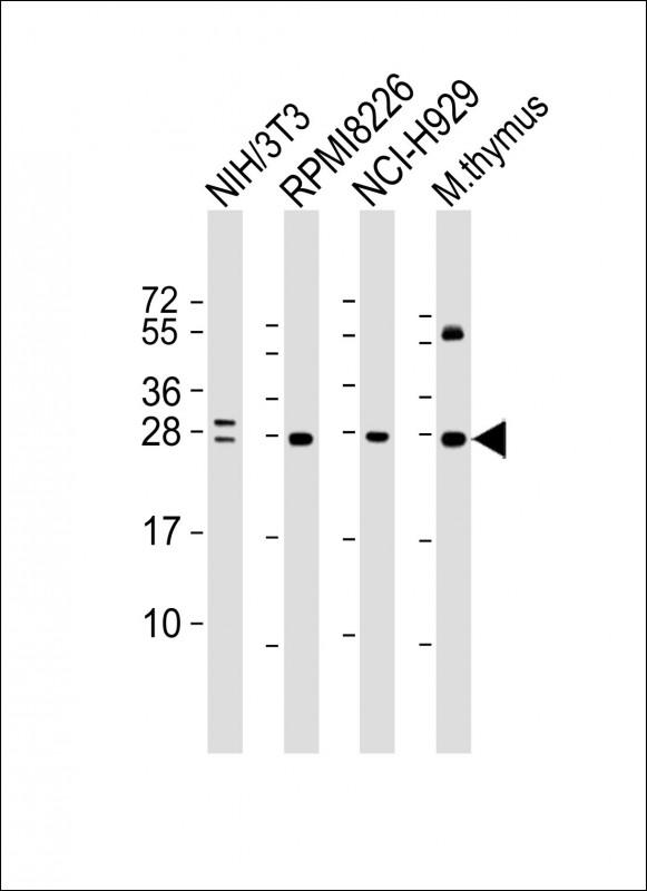 Mouse Monoclonal Antibody to FGFR1OP2