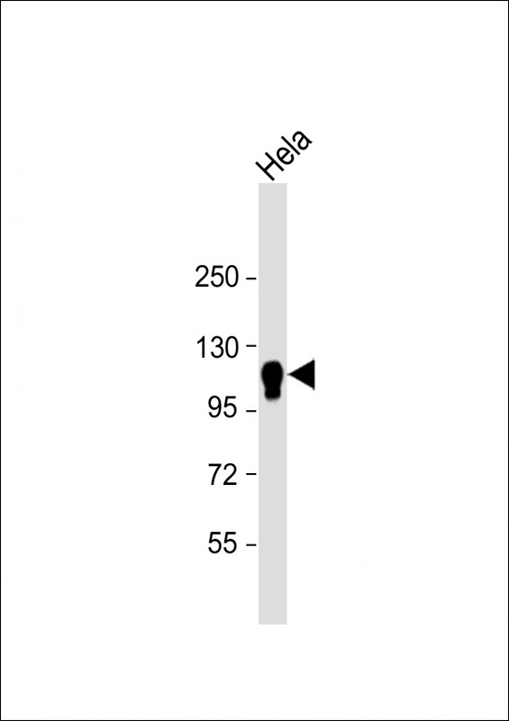 Mouse Monoclonal Antibody to CYLD