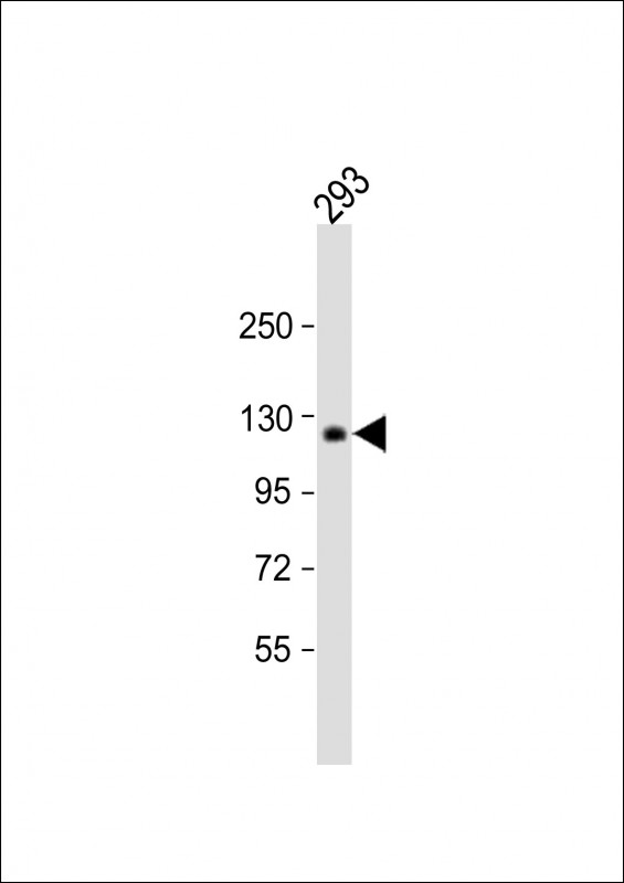 Rabbit Polyclonal Antibody to COL1A2 (N-term)