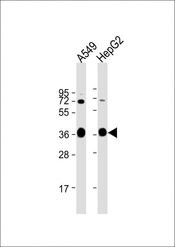 Rabbit Polyclonal Antibody to AKR1C3