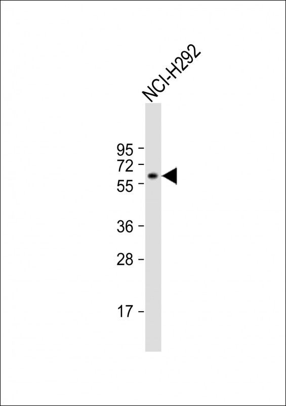 Rabbit Polyclonal Antibody to TBC1D3E