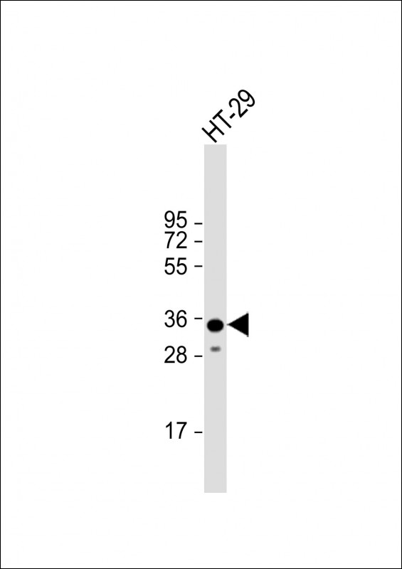 Rabbit Polyclonal Antibody to LGALS4 (N-term)