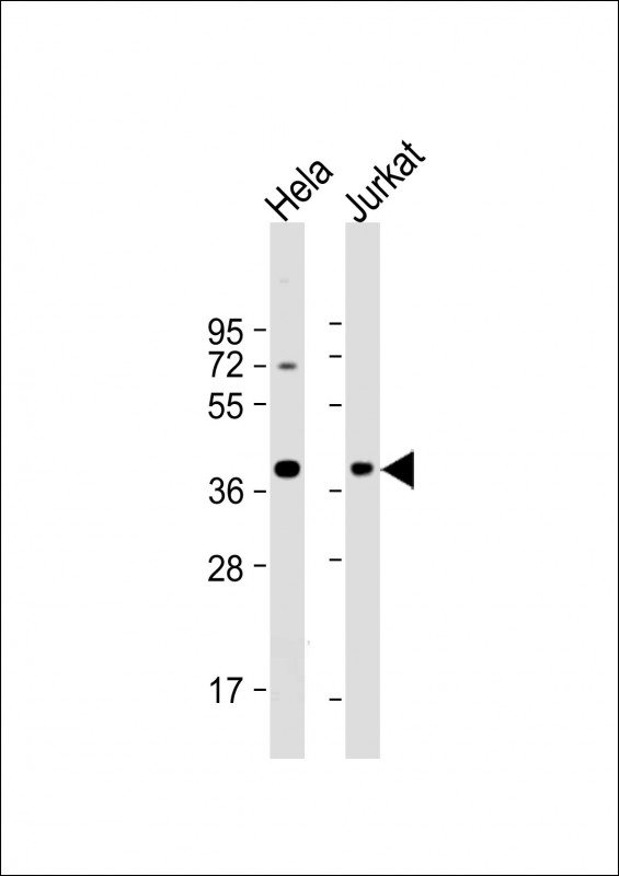 Rabbit Polyclonal Antibody to HSP40