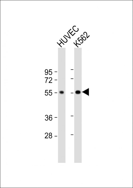 Rabbit Polyclonal Antibody to AVPR1B