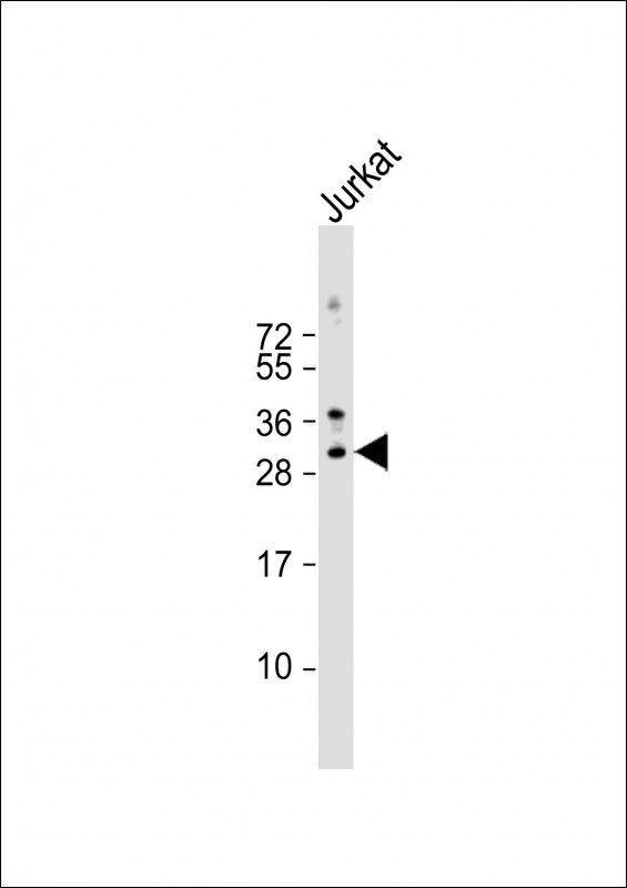 Rabbit Polyclonal Antibody to MEOX1