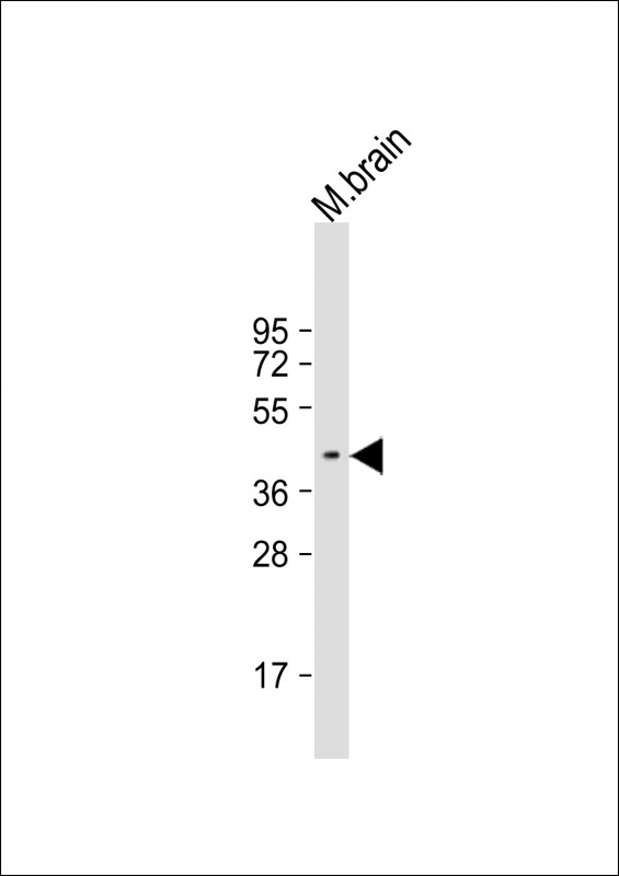 Rabbit Polyclonal Antibody to E2F3