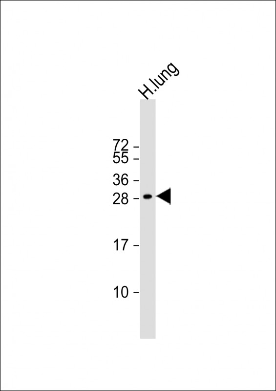 Rabbit Polyclonal Antibody to MXI1