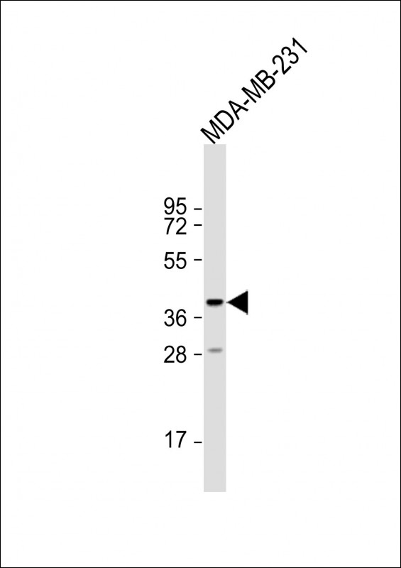 Rabbit Polyclonal Antibody to TAS2R31