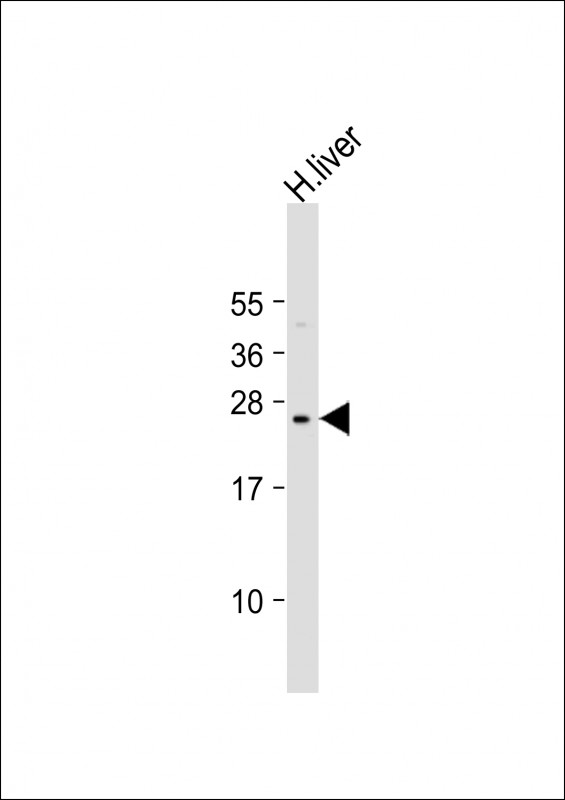 Rabbit Polyclonal Antibody to PTTG2