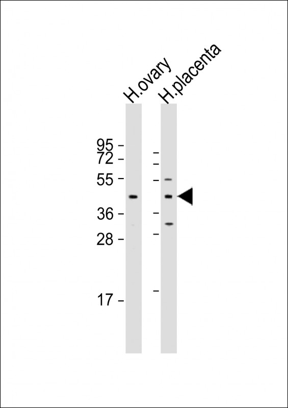 Rabbit Polyclonal Antibody to ESX1 (N-term)
