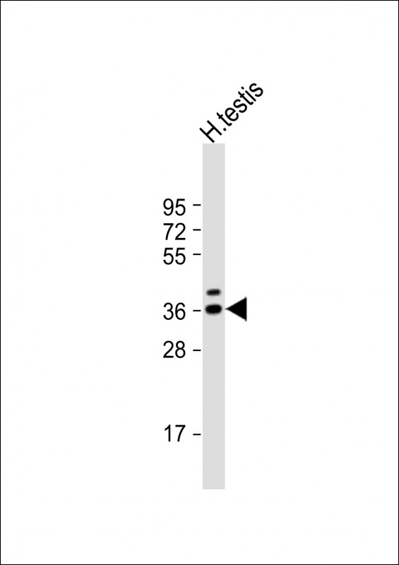 Rabbit Polyclonal Antibody to TSPY3