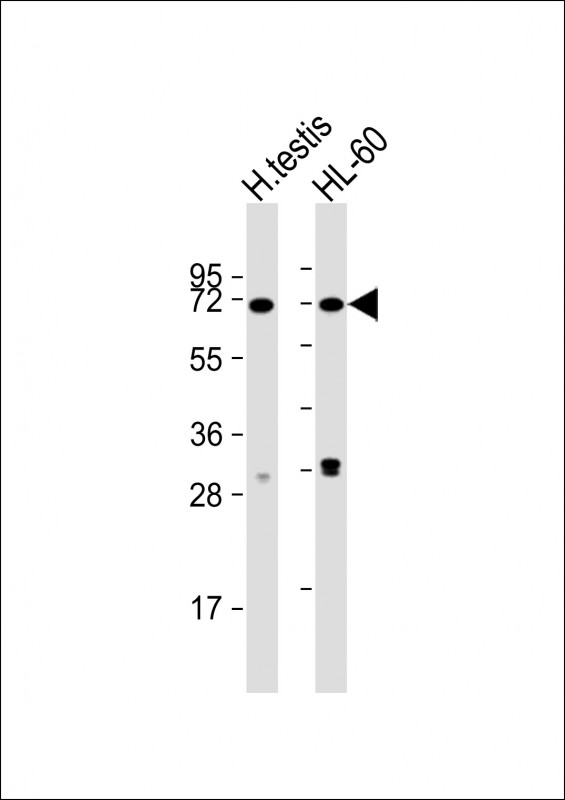 Rabbit Polyclonal Antibody to CCIN